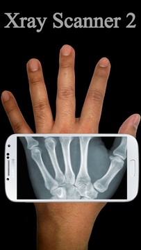 Xray Scanner Prank 2图片2