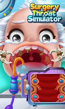 喉咙手术模拟 - 免费医生游戏图片2