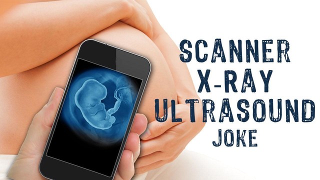 扫描仪的X射线超声笑话图片2