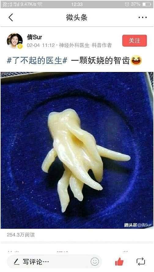 这种智齿怎么拔？