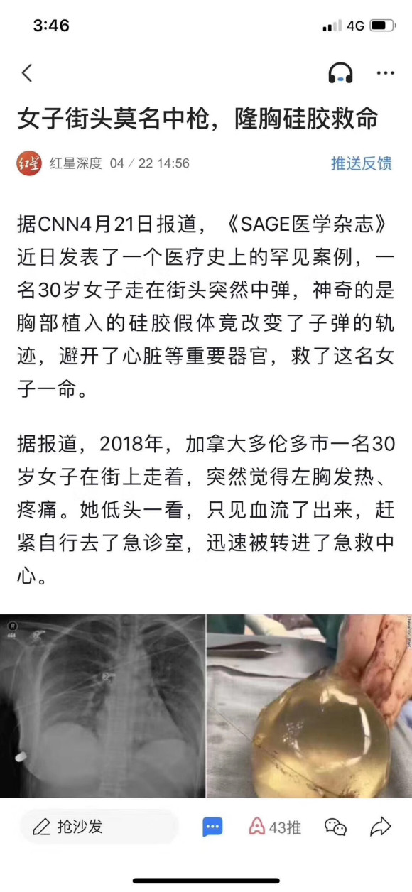 隆胸吗？ 挡子弹的那种