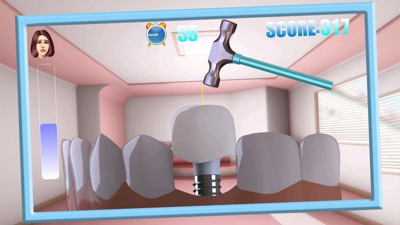 虚拟牙医手术治疗截图2