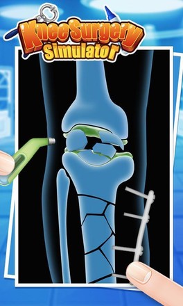 膝盖手术模拟 - 外科医生游戏截图1